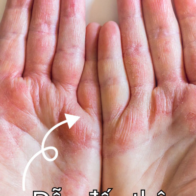 Xả Kho Găng Tay Cao Su Tự Nhiên Hàn Quốc Thương Hiệu BEIGL Có Móc Đủ Kích Cỡ