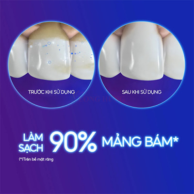 Kem đánh răng Crest 3D White Radiant Mint (93g) - Hàng chính hãng