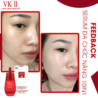 Serum Đa Chức Năng 10 in 1 VK II 35ml