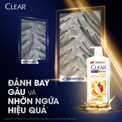 Dầu Gội Clear Thảo Dược Nuôi Dưỡng Da Đầu Từ Gốc, Sạch Gàu Và Giảm Gãy Rụng 630g - Gừng & Hoa Cúc