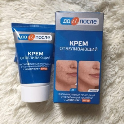 Kem giảm nám xanh Kpem Before and After до и после Nga - Kem giảm nám trắng da Nga Kpem 