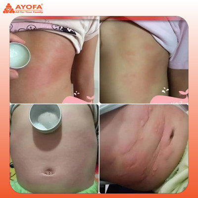 Cao Xoa Bóp Massage Thảo Dược Giúp Phục Hồi Và Làm Dịu Nhanh Chóng Ayofa Relax Hương Quế 60G