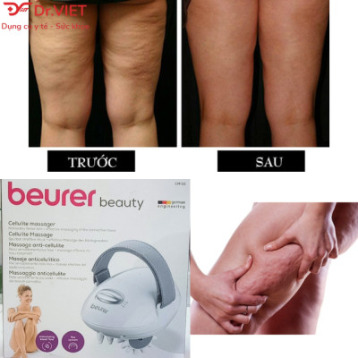 Máy massage cầm tay Beurer CM50 Hàng chính hãng - Xuất xứ Đức, thúc đẩy lưu thông máu, làm săn chắc da