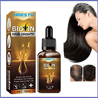 Chai xịt dưỡng kích mọc tóc, giúp tóc mọc dài nhiều và dày, mọc tóc nhanh, bóng, mượt, ngăn rụng tóc xuất xứ Singapore - Mã số 1102