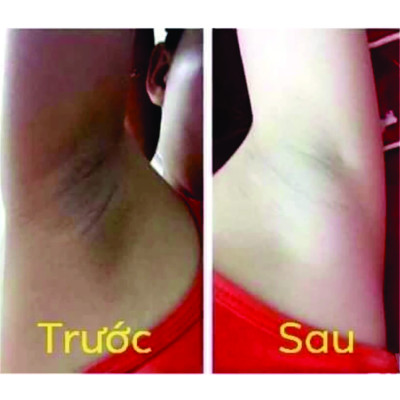 Kem Thâm Nách Hôi Nách, Kem Cô Bơ Đông Y Gia Truyền, Giúp Loại Bỏ Mùi Hôi, Dưỡng Trắng Nách Chiết Xuất Từ Thiên Nhiên