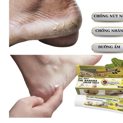 Kem chuối dưỡng da tay và nứt gót chân BIO WAY THE BANANA CREAM HELLS - Thailan