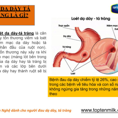 Sữa nghệ curcumin 800g TOPTEN Milk sữa bột cho người bị đau dạ dày tá tràng,phụ nữ sau sinh ,đẹp da