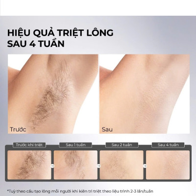 Máy Triệt Lông Lạnh Sapphire Halio InfinityGlow Advanced IPL Sapphire Cooling Hair Removal Device - Hàng Chính Hãng