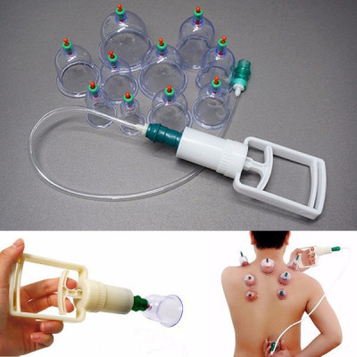  Bộ Giác Hơi Hút Chân Không 10  Cốc Siêu Hot Không Dùng Lửa GH10